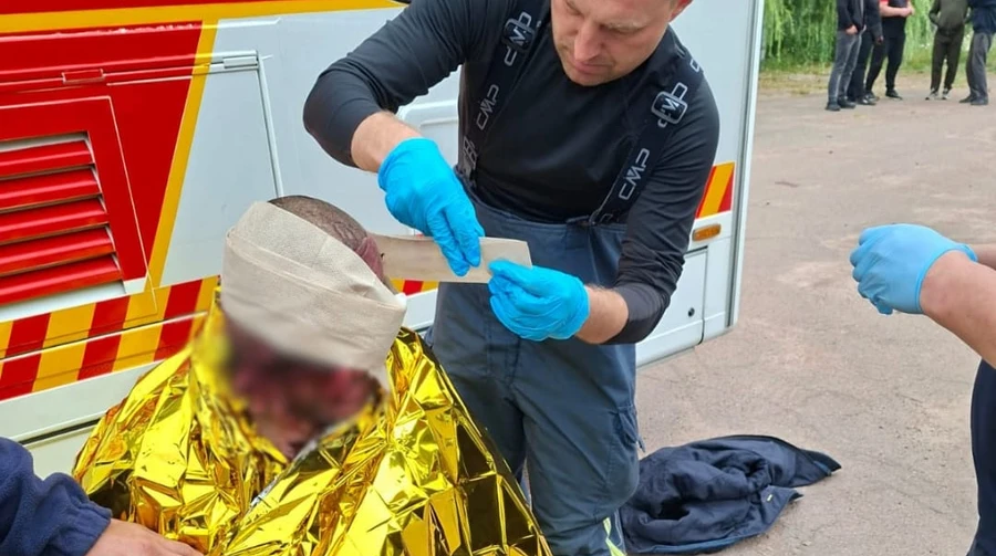 На Житомирщині росіяни атакували агропідприємство: постраждали 6 людей, з них троє дітей