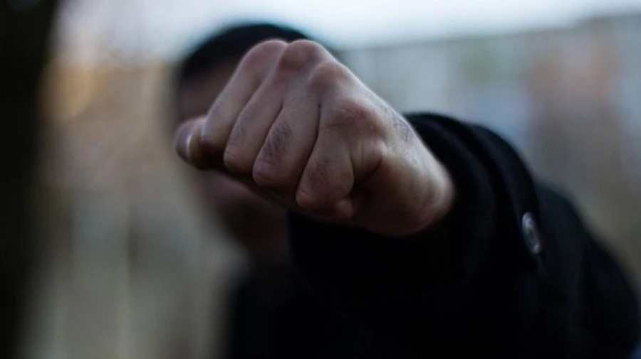 Мужчина после замечания до комы избил бойца ООС - полиция