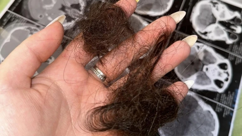 Толпа людей встречала работников ТЦК на Франковщине: пострадали две женщины и ребенок