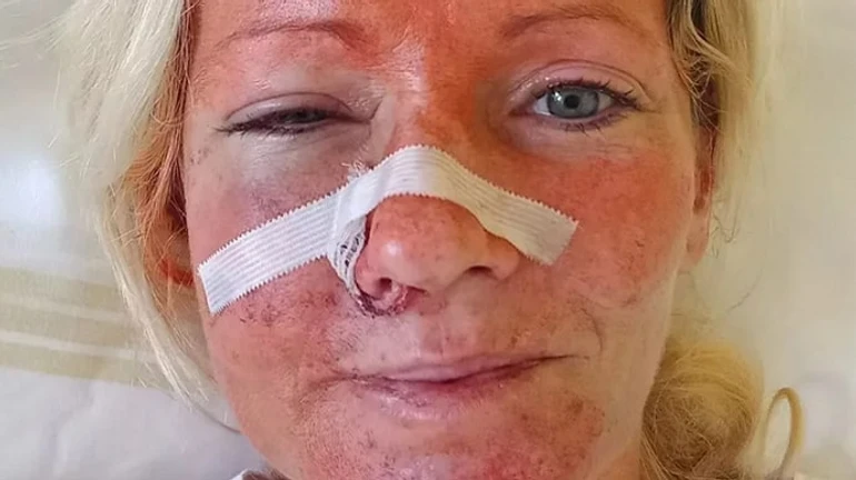 Czech police arrest suspect in brutal beating of Ukrainians