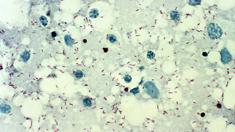 Russian Defence Ministry scares Russians with tales of arthropods and hantaviruses in Ukraine