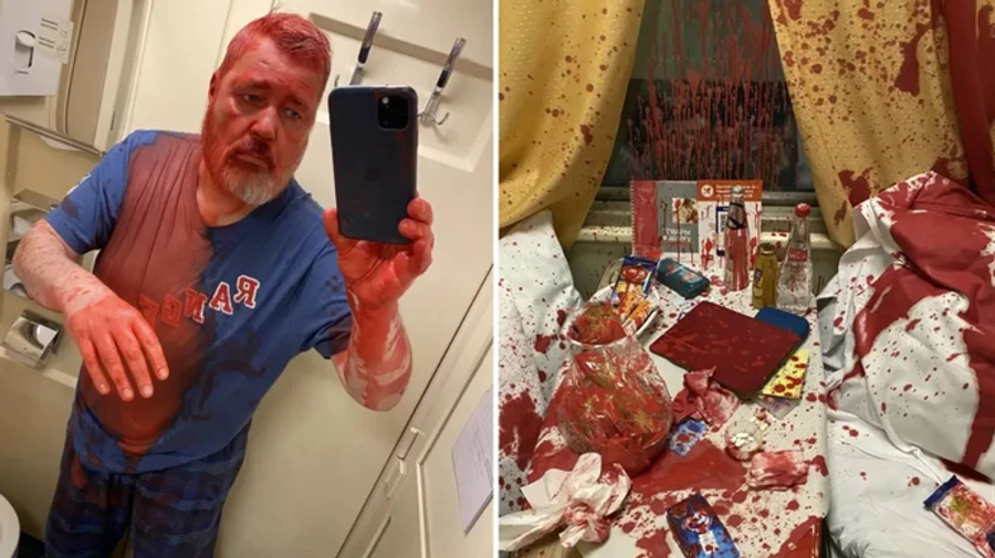 Attack on Novaya Gazeta editor linked to Russian security forces and separatist militants – media