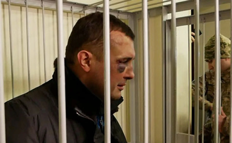 СБУ прокоментувала синці екс-депутата Шепелєва