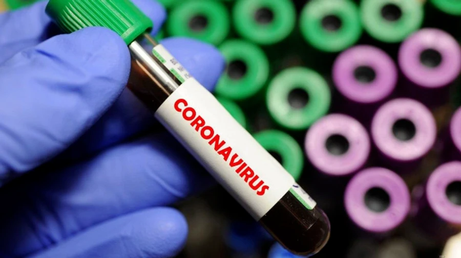 Италия зафиксировала самое малое с осени количество смертей от COVID-19