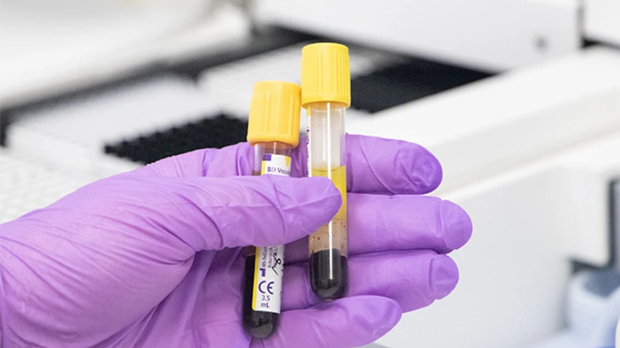 В Киеве за сутки более 1200 больных ковид, из них 126 – детей