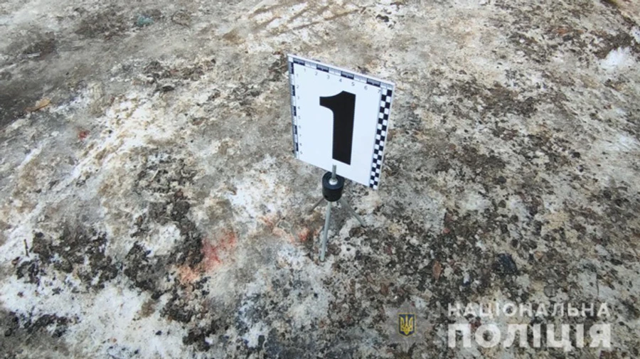 В Одессе мужчина ходил по улице с человеческой головой в руках