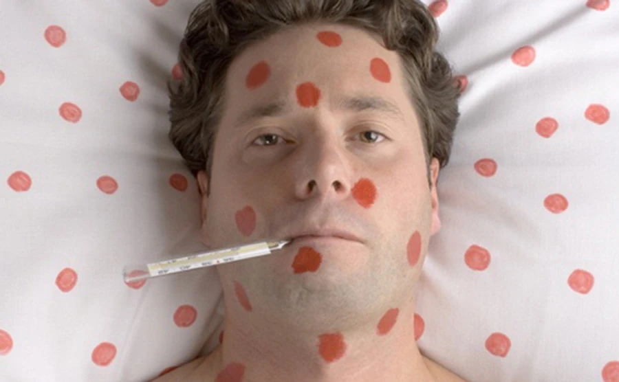 В Минздраве уточнили статистику заболеваемости корью