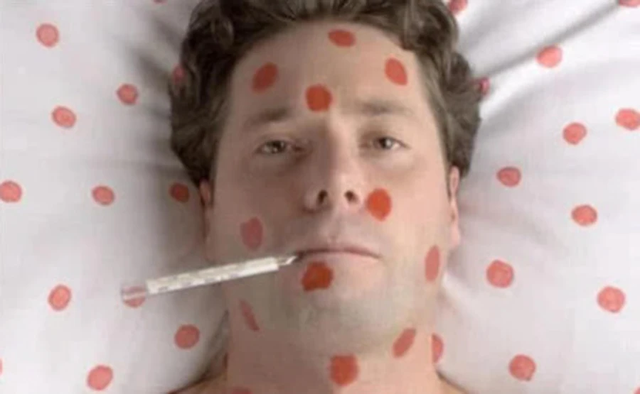 Минздрав: С начала года корью заболели более 5 тысяч человек