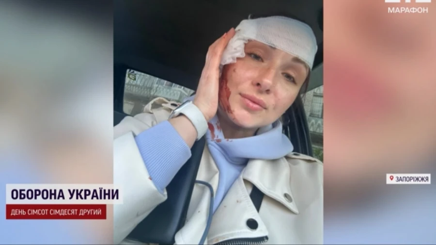 Ukrainian journalists injured in Russian strike on Zaporizhzhia – photo, video