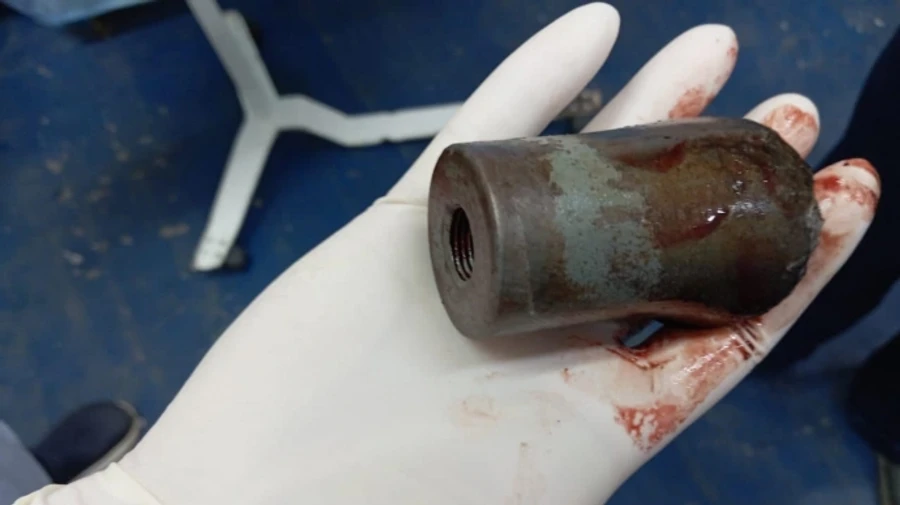 Doctors extract unidentified cluster munition from Ukrainian defender's leg at field hospital – photo