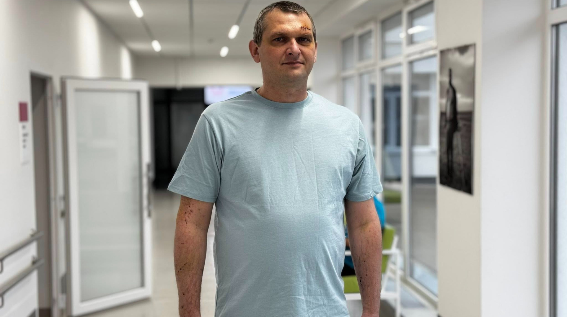Ten-centimetre shard of glass removed from chest: Lviv doctors save man injured in Russian drone attack – photo
