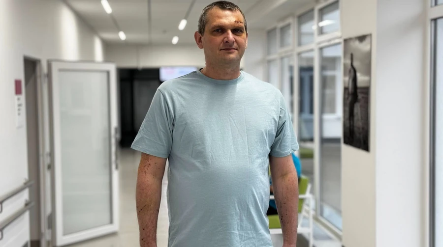 Ten-centimetre shard of glass removed from chest: Lviv doctors save man injured in Russian drone attack – photo