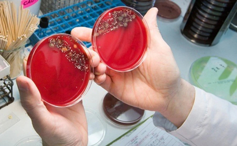 У таборі, де отруїлись діти, виявили стафілокок та патогенну флору