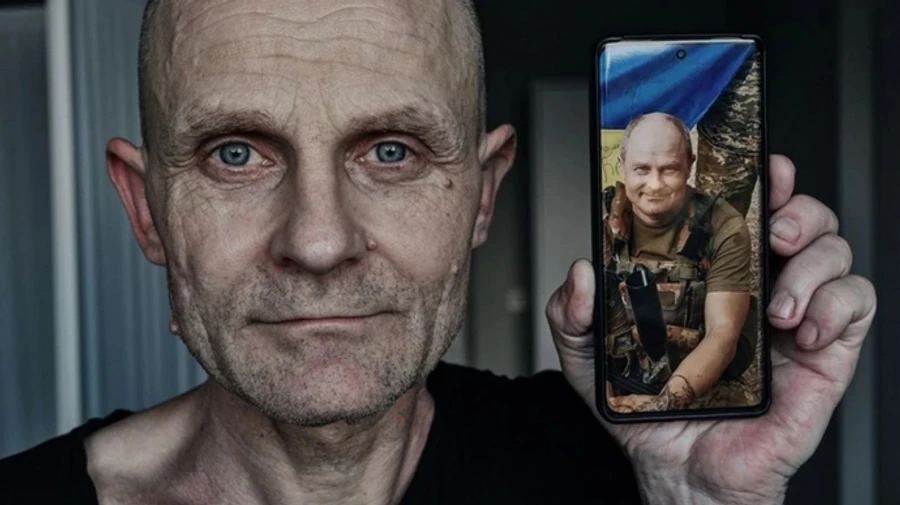 They lost 40kg of weight: photographers post pictures of Ukrainian soldiers after Russian captivity