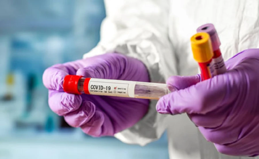 Больницы ОРДЛО переполнены больными коронавирусом – командующий ОС