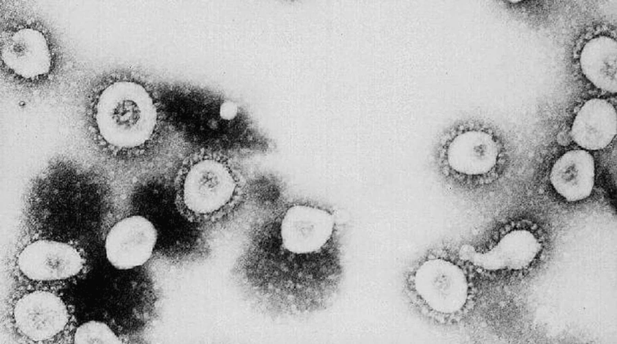 Головний лікар Англії: Очікуємо появу нових Covid-варіантів, стійких до вакцин