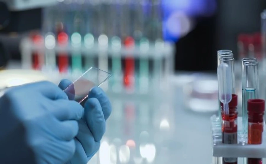 В Италии шестой день подряд уменьшается количество больных в реанимации