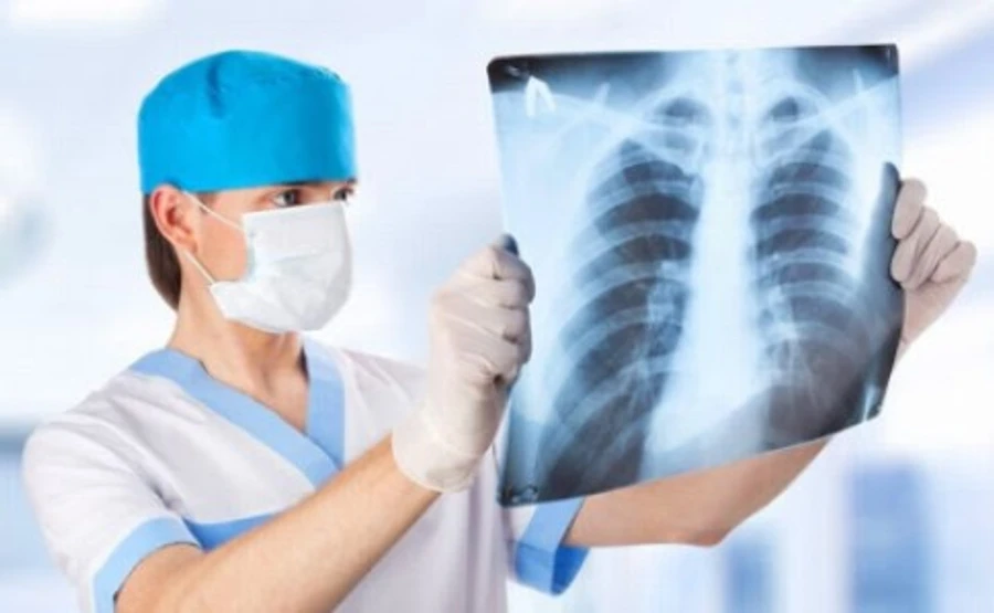 Понад 600 українців померли від грипу і пневмонії в січні – Держстат