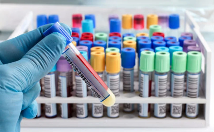 Зеленський каже, що з датою аналізів стався казус