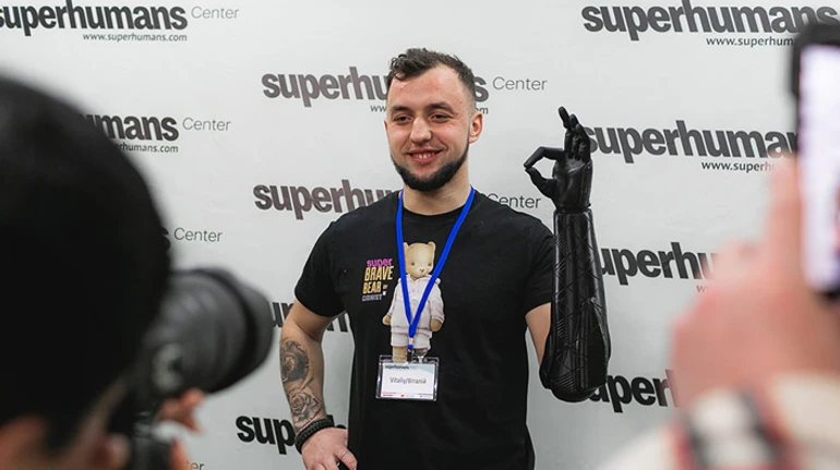 Щастя знову мати руку. Військовий про поранення, ампутацію та електричний протез