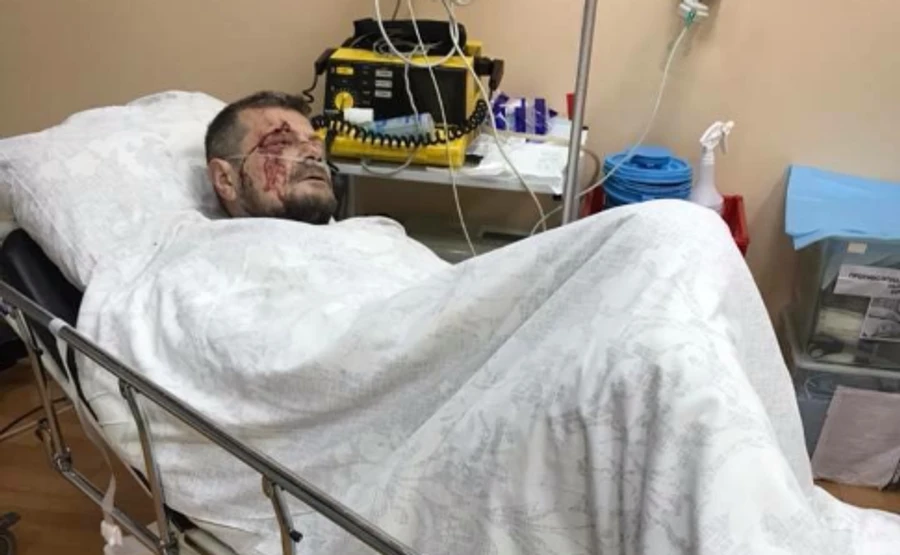 Врачи о Мосийчуке: Состояние тяжелое, ждет новую операцию