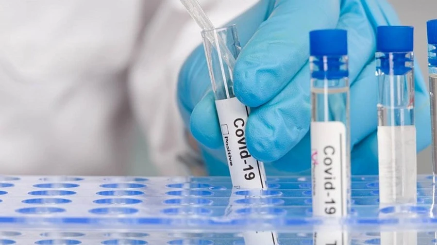 COVID у світі: за поширенням у світі лідирують США і Британія