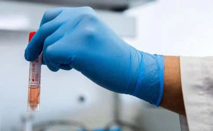 У Дніпрі на коронавірус перевіряють 8 осіб