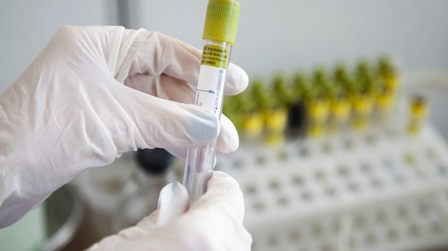 Україна – 2-га в Європі за смертністю від COVID за добу