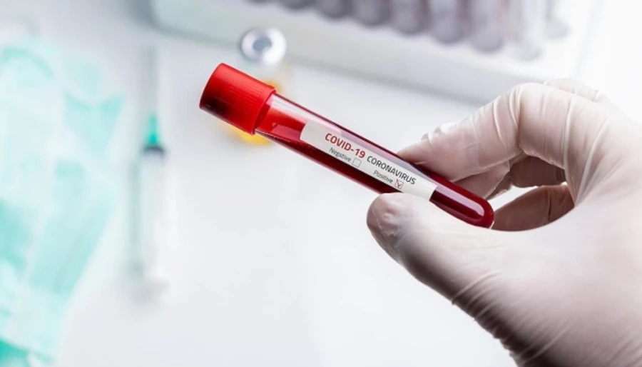 У МОЗ оновили перелік зелених та червоних країн