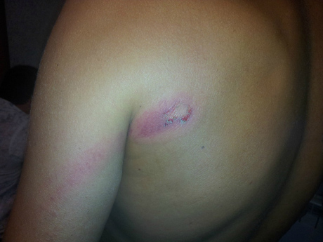 Пострадавший активист Федор Добрицын. Фото pauluskp 