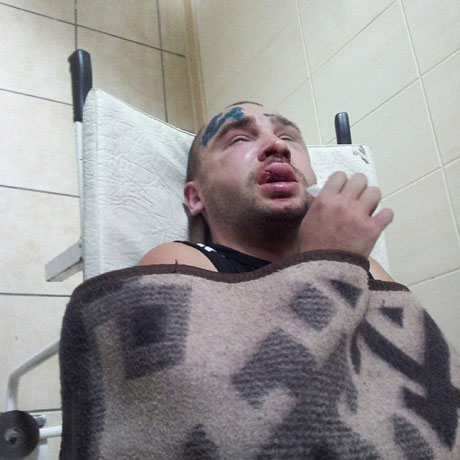 Побитий активіст. Фото з Facebook Павла Колесника Побитий активіст. Фото з Facebook Павла Колесника