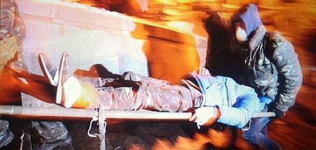 Поранений. Фото: Наталя Седлецька Поранений. Фото: Наталя Седлецька