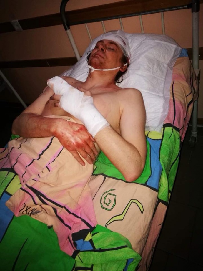 У Кривому Розі напали на громадського діяча та співзасновника партії 