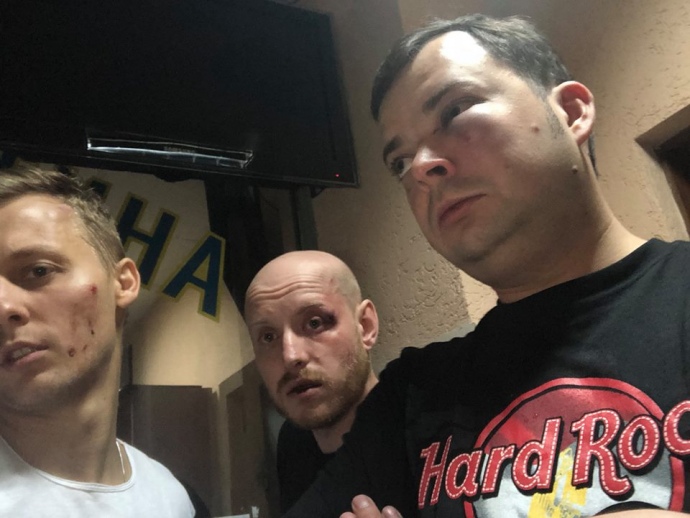 Нестор Шуфрич заявив, що його сина Олександра з товаришами побили невідомі. 