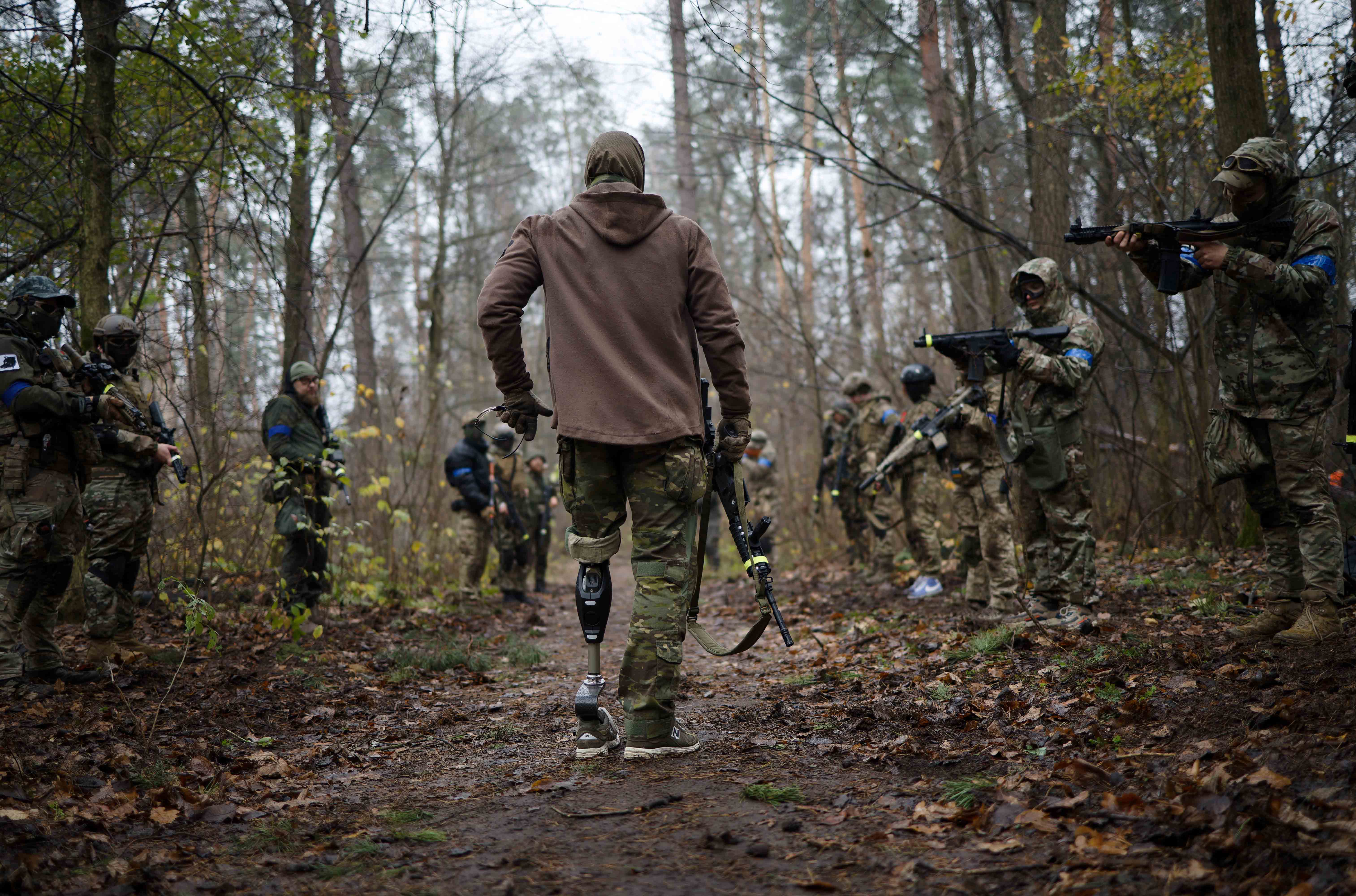 Раніше непридатними вважались або люди з двосторонньою ампутацією кінцівок, або з ампутацією ноги вище рівня верхньої третини гомілки