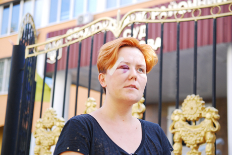 Избитая в субботу лидер Femen Анна Гуцол Избитая в субботу лидер Femen Анна Гуцол