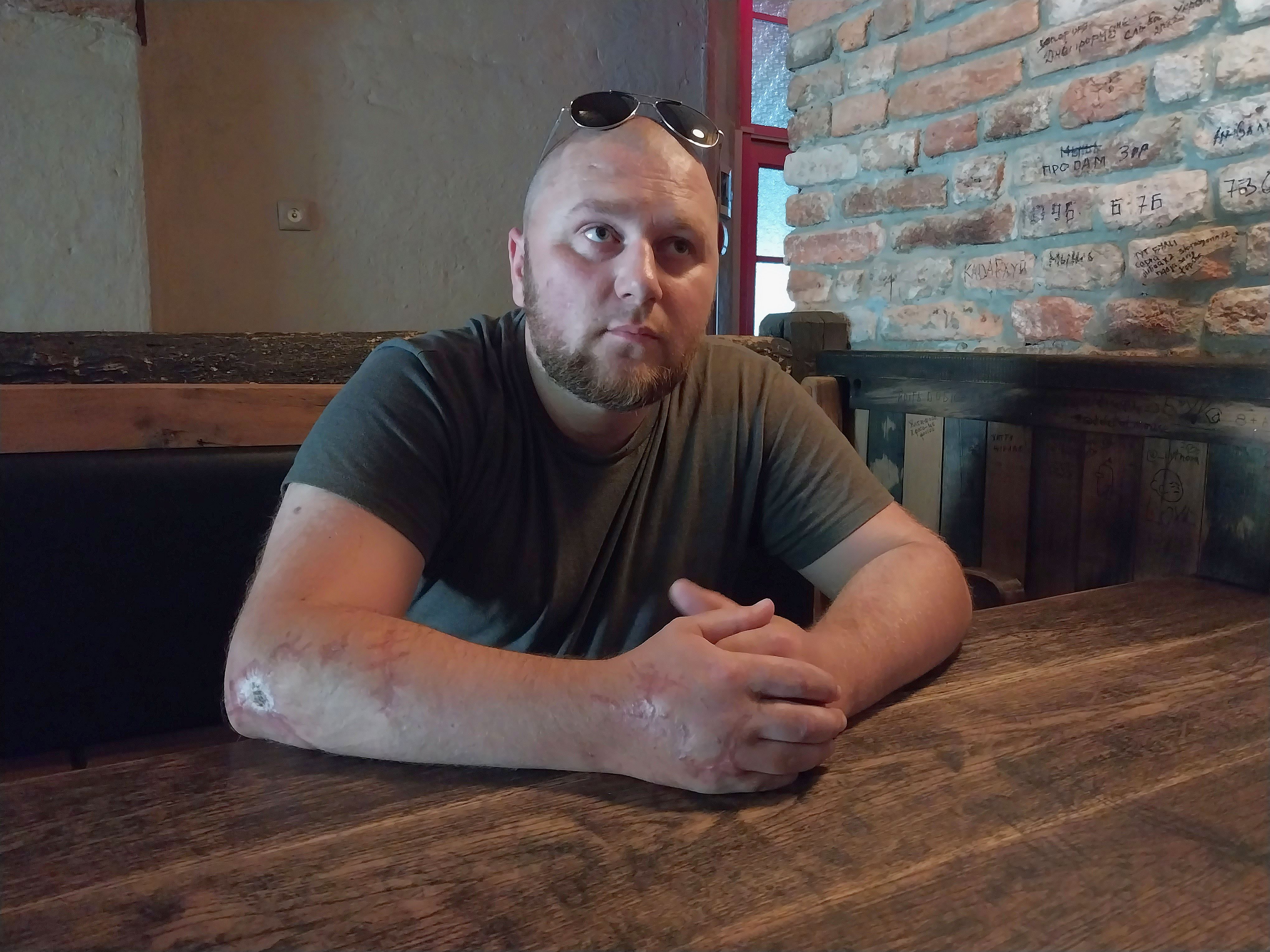 17.02.2023 року Павло отримав важке поранення від ворожого іранського ПТУРу