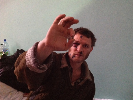 Один з постраждалих