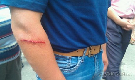 В Одессе подрались из-за Фарион В Одессе подрались из-за Фарион