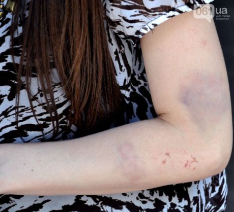 Дарья Радченко, дочь активистки, пострадала