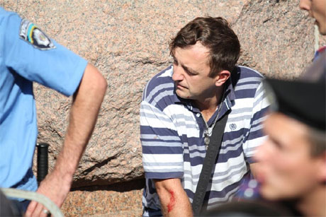 Леонов с пораненной рукой