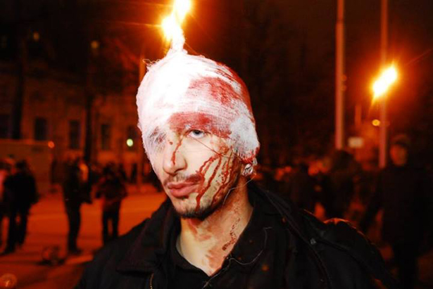 Постраждалий під час дриаки з Беркутом біля адміністрації президента. Фото Ярослава Дебелого