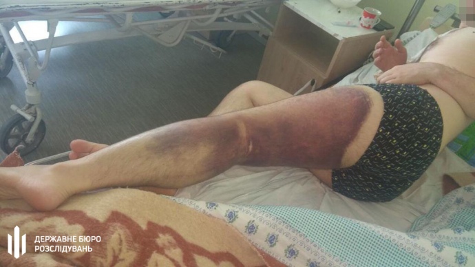 Побитий поліцейськими і курсантом чоловік.