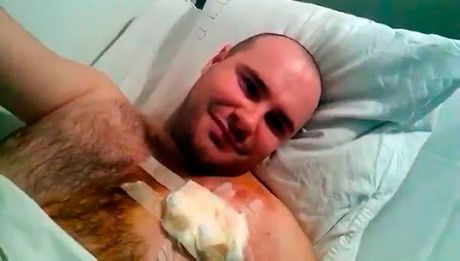 Поранений Маралов