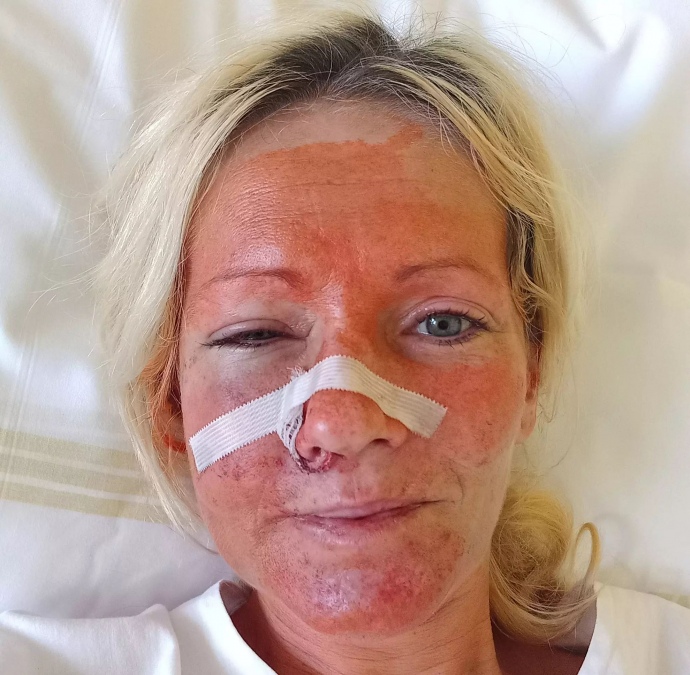 Младшая из избитых в Чехии украинок попала в больницу